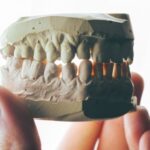 【夢占い】歯が抜ける夢は変化の兆し!1本だけ、全部、虫歯の意味