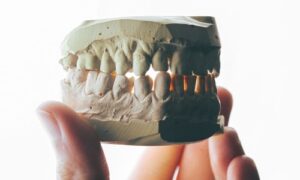 【夢占い】歯が抜ける夢は変化の兆し!1本だけ、全部、虫歯の意味